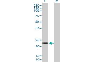 DYDC2 anticorps  (AA 1-177)