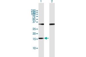 Western Blot analysis of POP7 expression in transfected 293T cell line by POP7 MaxPab polyclonal antibody. (POP7 anticorps  (AA 1-140))