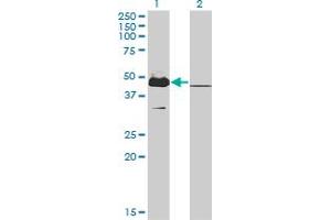 Western Blot analysis of MKRN2 expression in transfected 293T cell line by MKRN2 monoclonal antibody (M01), clone 5F8. (MKRN2 anticorps  (AA 317-415))