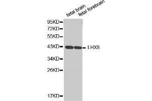 Western blot analysis of extracts of various cell lines, using LHX8antibody. (LHX8 anticorps  (AA 1-220))
