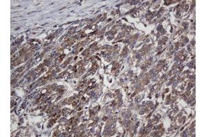 Immunohistochemistry (IHC) image for anti-Crystallin, alpha A (CRYAA) antibody (ABIN1498754)