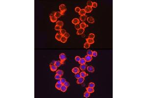 Immunofluorescence analysis of  cells using THBD Rabbit pAb (ABIN1683026, ABIN3018621, ABIN3018622 and ABIN6220518) at dilution of 1:50 (40x lens). (Thrombomodulin anticorps  (AA 200-500))