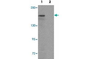 Western blot analysis of ATP2C1 in mouse brain tissue lysate with ATP2C1 polyclonal antibody  at 1 ug/mL in (1) the absence and (2) the presence of blocking peptide. (ATP2C1 anticorps  (C-Term))