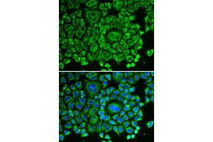 Immunofluorescence analysis of HeLa cells using ARHGDIA antibody. (ARHGDIA anticorps)