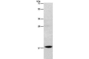 Western Blot analysis of Mouse stomach tissue using GRP Polyclonal Antibody at dilution of 1:1000 (Gastrin-Releasing Peptide anticorps)