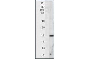Image no. 1 for anti-Superoxide Dismutase 2, Mitochondrial (SOD2) antibody (ABIN264858) (SOD2 anticorps)
