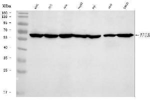 Western blot analysis of TFEB using anti-TFEB antibody (ABIN7600648).