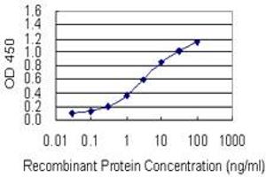 Detection limit for recombinant GST tagged RAI1 is 0.