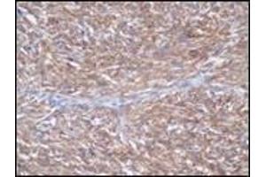 Immunohistochemistry (IHC) image for anti-Mast/stem Cell Growth Factor Receptor (KIT) (C-Term) antibody (ABIN870476)