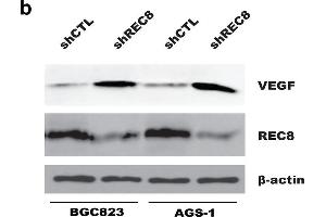 Depletion of REC8 enhanced HUVECs migration and tube formation through upregulation of VEGF in gastric cancer cells. (VEGFA anticorps  (AA 27-126))