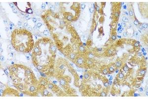 Immunohistochemistry of paraffin-embedded Mouse kidney using ACOT2 Polyclonal Antibody at dilution of 1:100 (40x lens). (ACOT2 anticorps)