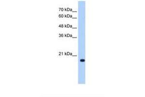 Image no. 1 for anti-DCTP Pyrophosphatase 1 (DCTPP1) (N-Term) antibody (ABIN321098) (DCTPP1 anticorps  (N-Term))