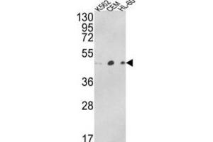 Western Blotting (WB) image for anti-ARP3 Actin-Related Protein 3 Homolog B (ACTR3B) antibody (ABIN3003796) (ACTR3B anticorps)