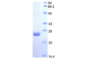 SDS-PAGE analysis of Human Protein S Protein. (PROS1 Protéine)