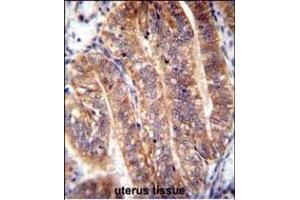 NUMB Antibody (N-term) (ABIN655396 and ABIN2844944) immunohistochemistry analysis in formalin fixed and paraffin embedded human uterus tissue followed by peroxidase conjugation of the secondary antibody and DAB staining. (NUMB anticorps  (N-Term))