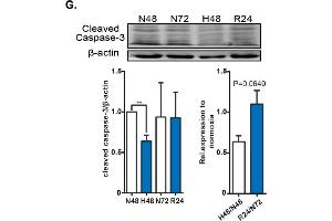 NgBR expression is downregulated in the pulmonary artery of HPH rat model and in vascular smooth muscle cells (VSMCs) exposed to hypoxia.