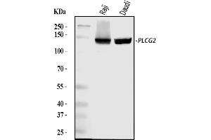 Western blot analysis of PLCG 2/PLCG2 using anti-PLCG 2/PLCG2 antibody (ABIN5692854). (Phospholipase C gamma 2 anticorps  (AA 1201-1258))
