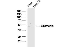 Lane 1: Hela lysates Lane 2: HepG2 lysates probed with Gliomedin Polyclonal Antibody, Unconjugated  at 1:300 dilution and 4˚C overnight incubation. (GLDN anticorps  (AA 365-460))