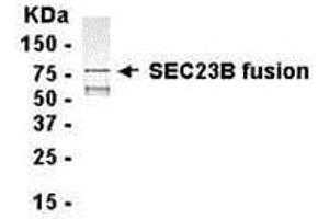 Western Blotting (WB) image for anti-Sec23 Homolog B (SEC23B) (AA 219-530) antibody (ABIN2468160) (Sec23 Homolog B anticorps  (AA 219-530))