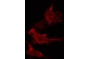 ABIN6275607 staining  HeLa cells by IF/ICC. (SFRS2B anticorps  (Internal Region))