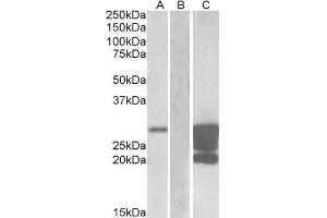HEK293 lysate (10ug protein in RIPA buffer) overexpressing Human GM2A with DYKDDDDK tag probed with ABIN625813 (1. (GM2A anticorps  (AA 179-189))