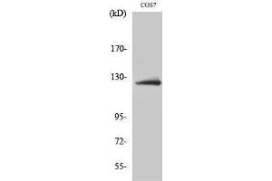 Western Blotting (WB) image for anti-ATP Citrate Lyase (ACLY) (Ser1227) antibody (ABIN3173960) (ACLY anticorps  (Ser1227))