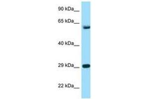 Image no. 1 for anti-T-Complex 1 (TCP1) (AA 471-520) antibody (ABIN6748135) (TCP1 alpha/CCTA anticorps  (AA 471-520))