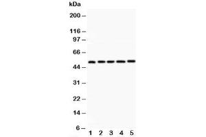 Western blot testing of LXR alpha antibody and Lane 1:  rat liver;  2: rat lung;  3: rat spleen;  4: rat kidney;  5: human placenta;  Predicted size: 51KD;  Observed size: 51KD