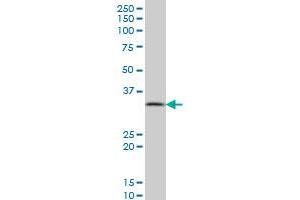 PPA1 monoclonal antibody (M01), clone 3B2 Western Blot analysis of PPA1 expression in A-431 .