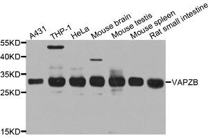 Western blot analysis of extracts of various cell lines, using CAPZB antibody. (CAPZB anticorps)