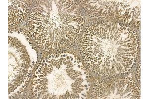 MTBP Mouse Monoclonal Antibody at 1/100 staining rat testis tissue by IHC-P. (MTBP anticorps)