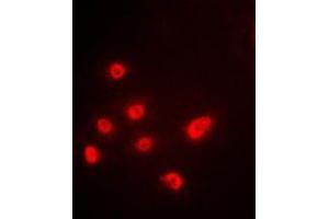 Immunofluorescent analysis of p63 staining in A549 cells. (TCP1 alpha/CCTA anticorps  (C-Term))