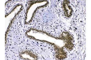 IHC analysis of MED18 using anti-MED18 antibody . (MED18 anticorps  (AA 1-208))