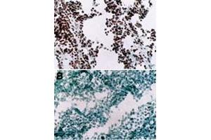 Immunohistochemistry (Frozen sections) using Myod1 monoclonal antibody, clone 5.