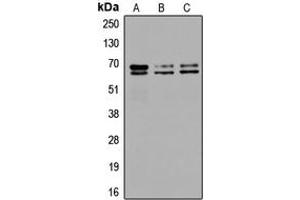 Western blot analysis of GAD1/2 expression in SKNSH (A), SP2/0 (B), PC12 (C) whole cell lysates. (GAD65+GAD67 (C-Term) anticorps)