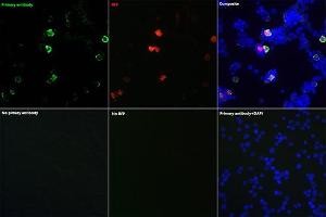 Immunofluorescence analysis of 293T cells transfected with mCherry-Tag fusion protein and untreated 293T cells use Mouse anti mCherry-Tag mAb (ABIN7268432) at dilution of 1:100 (40x lens). (mCherry anticorps)