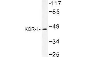 Image no. 1 for anti-Opioid Receptor, kappa 1 (OPRK1) antibody (ABIN317765) (OPRK1 anticorps)