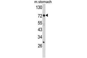 Western blot analysis of ZFP36 Antibody (ZNF823 anticorps  (Middle Region))