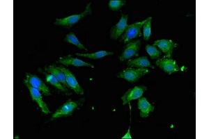 anti-Autophagy related 4C Cysteine Peptidase (ATG4C) (AA 419-448) antibody