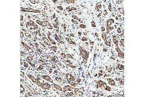 IHC analysis of PDK2 using anti-PDK2 antibody (ABIN5693279). (PDK2 anticorps  (AA 81-177))