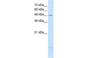 PSD3 antibody used at 2. (PSD3 anticorps  (Middle Region))
