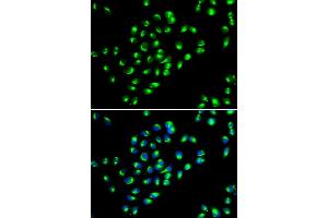 Immunofluorescence analysis of MCF-7 cells using GOLM1 antibody. (GOLM1 anticorps)