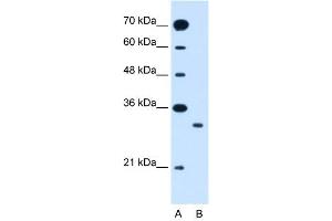 WB Suggested Anti-SLC25A22  Antibody Titration: 1. (SLC25A22 anticorps  (N-Term))