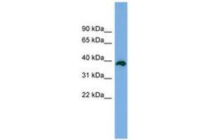 Image no. 1 for anti-Death Effector Domain Containing 2 (DEDD2) (AA 179-228) antibody (ABIN6744979) (DEDD2 anticorps  (AA 179-228))