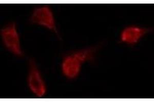 ABIN6275417 staining Hela by IF/ICC. (DYRK3 anticorps)