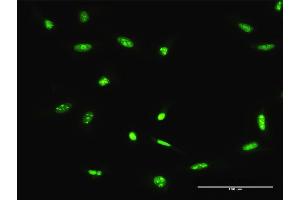 Immunofluorescence of purified MaxPab antibody to ADAR on HeLa cell.