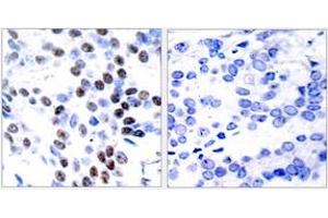 Immunohistochemistry (IHC) image for anti-Jun Proto-Oncogene (JUN) (AA 61-110) antibody (ABIN2889016) (C-JUN anticorps  (AA 61-110))