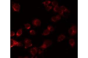 ABIN6276861 staining LOVO by IF/ICC. (Cadherin 13 anticorps  (Internal Region))