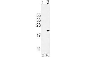 Western blot analysis of CDKN2C antibody and 293 cell lysate either nontransfected (Lane 1) or transiently transfected (2) with the CDKN2C gene. (CDKN2C anticorps  (AA 113-139))