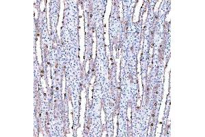 IHC analysis of SUCLG1 using anti-SUCLG1 antibody (ABIN7600906). (SUCLG1 anticorps  (AA 25-346))